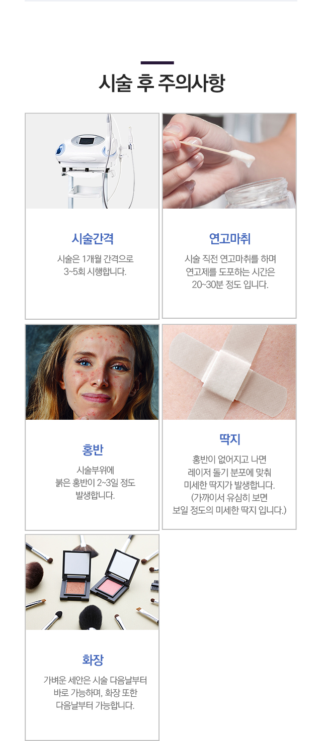 아이콘1540XD