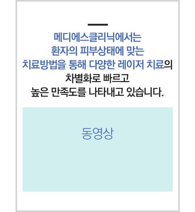 레가토 영상