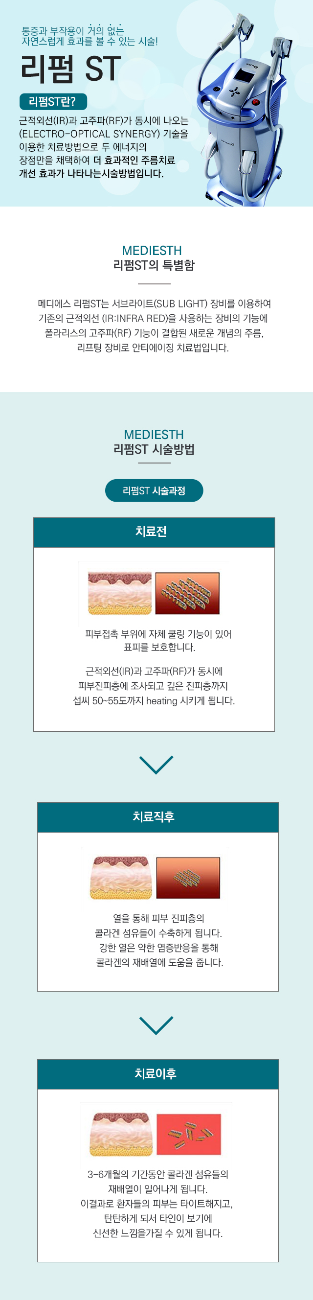리펌st