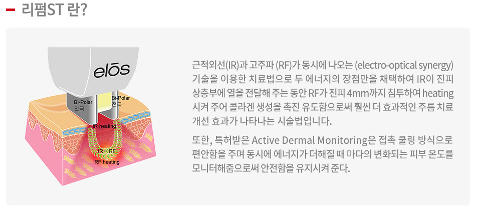 리펌ST