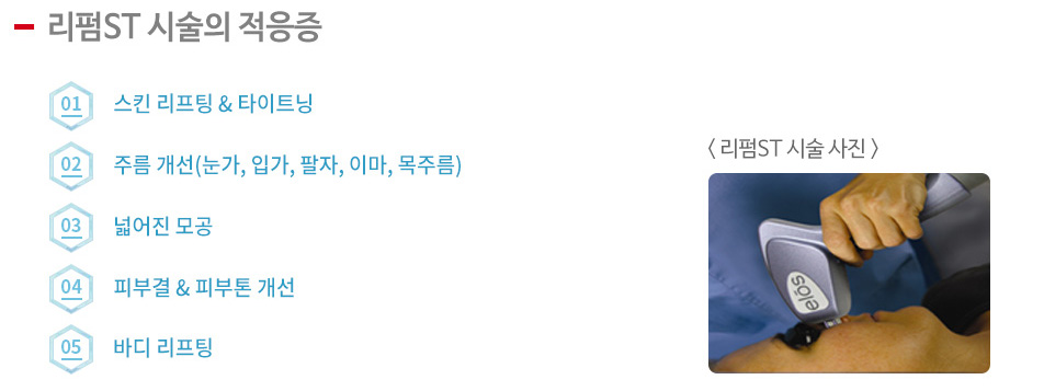 리펌ST