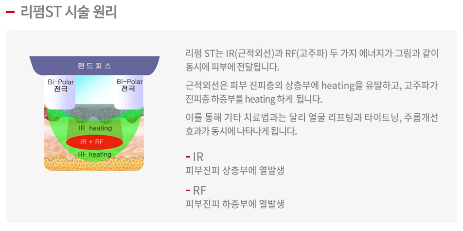 리펌ST